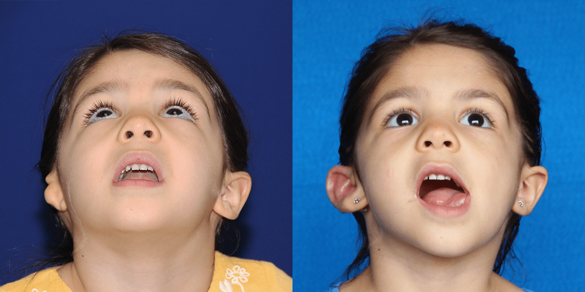 2_AVA_B&A_4MOPOST_BEYE