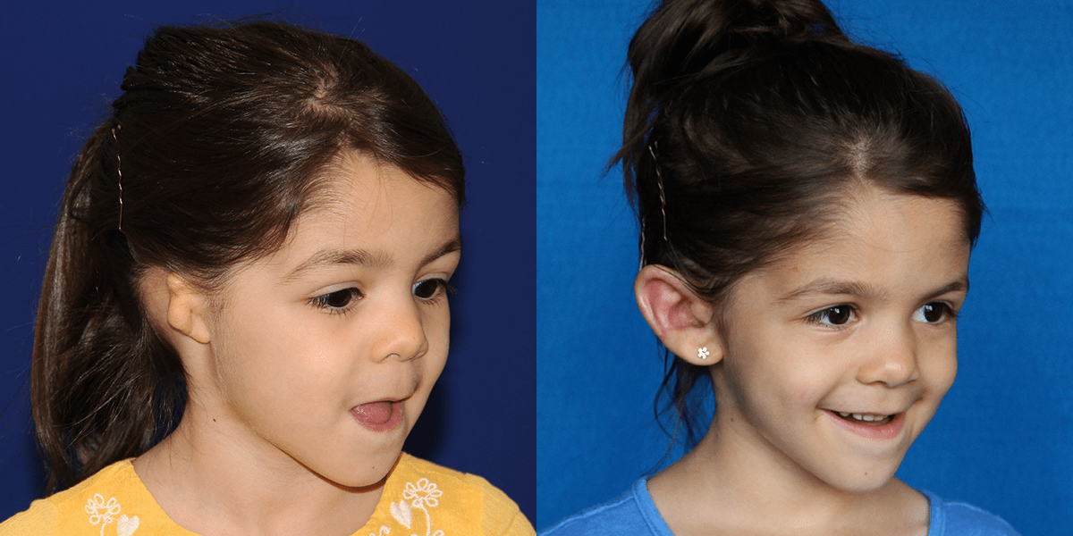 3_AVA_B&A_4MOPOST_R34