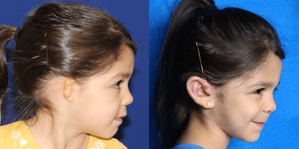 4_AVA.B&A_4MOPOST_RLAT