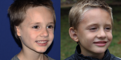 CAIDEN_B&A_34