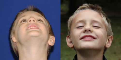 CAIDEN_B&A_BEYE